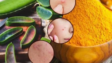 Photo of चेहरे से बाल हटा देगा एलोवेरा, इस तरह करें इस्तेमाल