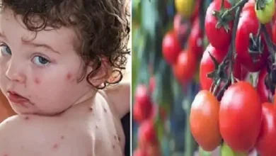 Photo of कोरोना, मंकीपॉक्स के बाद अब आया टोमैटो फीवर, पढ़े पूरी ख़बर