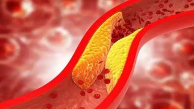 Photo of कोलेस्ट्रॉल को कम करने के लिए जरुर खाए ये चीजें