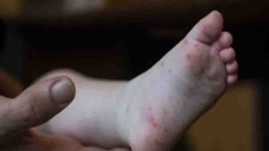 Photo of फुट एंड माउथ बीमारी जो की बच्चों में देखी गई है , तो आइए जानें इस बीमारी के बारे में
