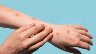Photo of केंद्र सरकार ने मंकीपाक्स के बढ़ते मामलों के बीच एडवाइजरी जारी की, संक्रमण से बचने के लिए..