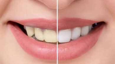 Photo of सफ़ेद चमकते दातों के लिए अपनाए ये उपाय…