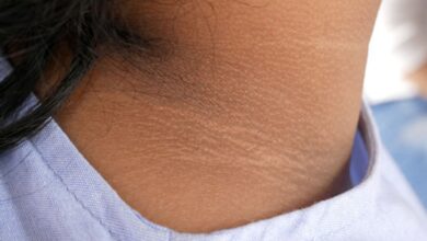Photo of गर्दन का कालापन दूर करने के लिए अपनाए ये असरदार तरीका…