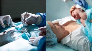 Photo of तो चलिए जानते हैं सी-सेक्शन से जुड़े कुछ आम मिथक और उनकी सच्चाई के बारे में-