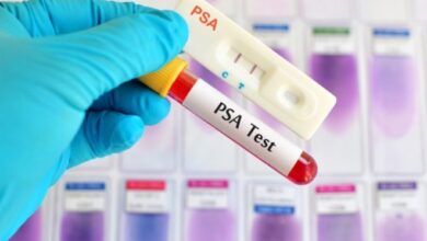 Photo of आज के लेख में PSA Test के फायदों के बारे में साथ ही साथ इसे करवाते समय किन- किन बातों का ध्यान रखना जरूरी है..