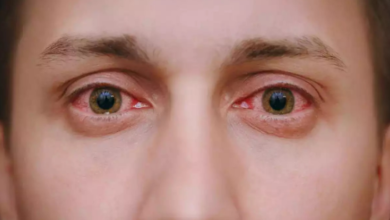 Photo of उत्तराखंड में तेजी से फैल रहा आई फ्लू,एक्सपर्ट से जानिए लक्षण और बचाव!